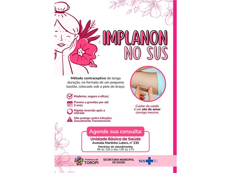 Saúde da Mulher: Implanon passa a ser ofertado gratuitamente pelo SUS em Toropi